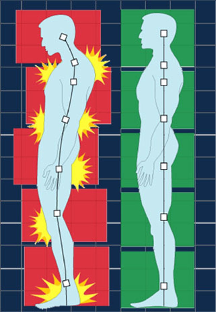 <p>поза, постава(the way in which someone usually holds their shoulders, neck, and back, or a particular position in which someone stands, sits, etc.: She's got very good/bad posture.)</p>