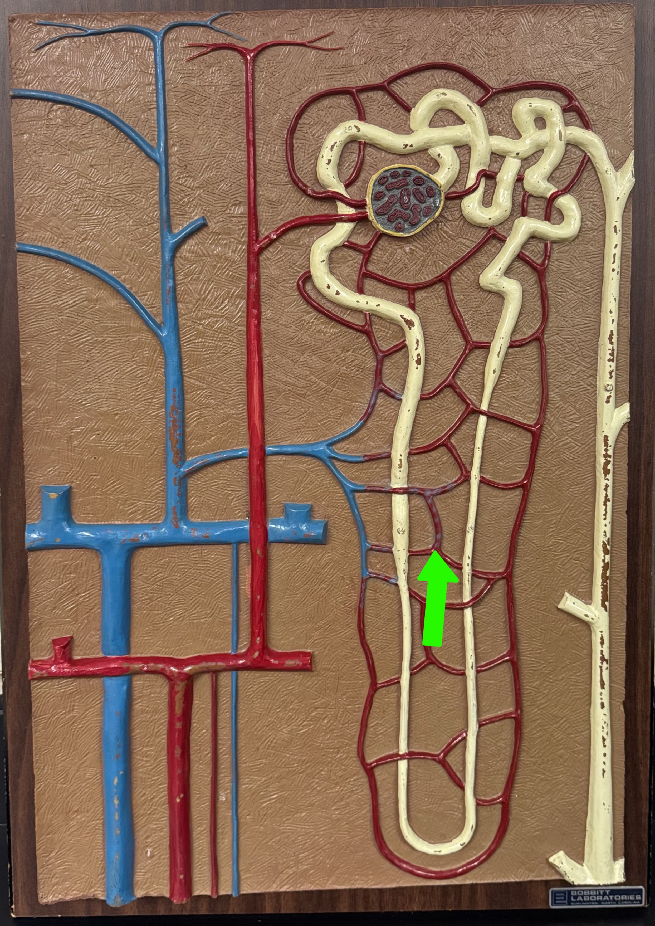 <p>What are these parts of the nephron?</p>