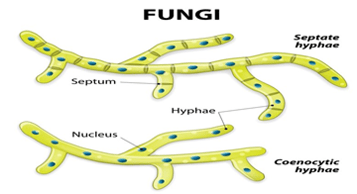 <p>The internal walls that separate the cells</p>