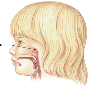 <p>Identify the tonsil labeled "C." </p>