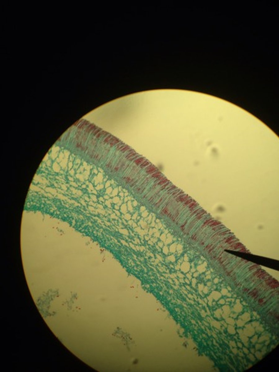 <p>fruiting body of ascomycetes made of several asci</p>