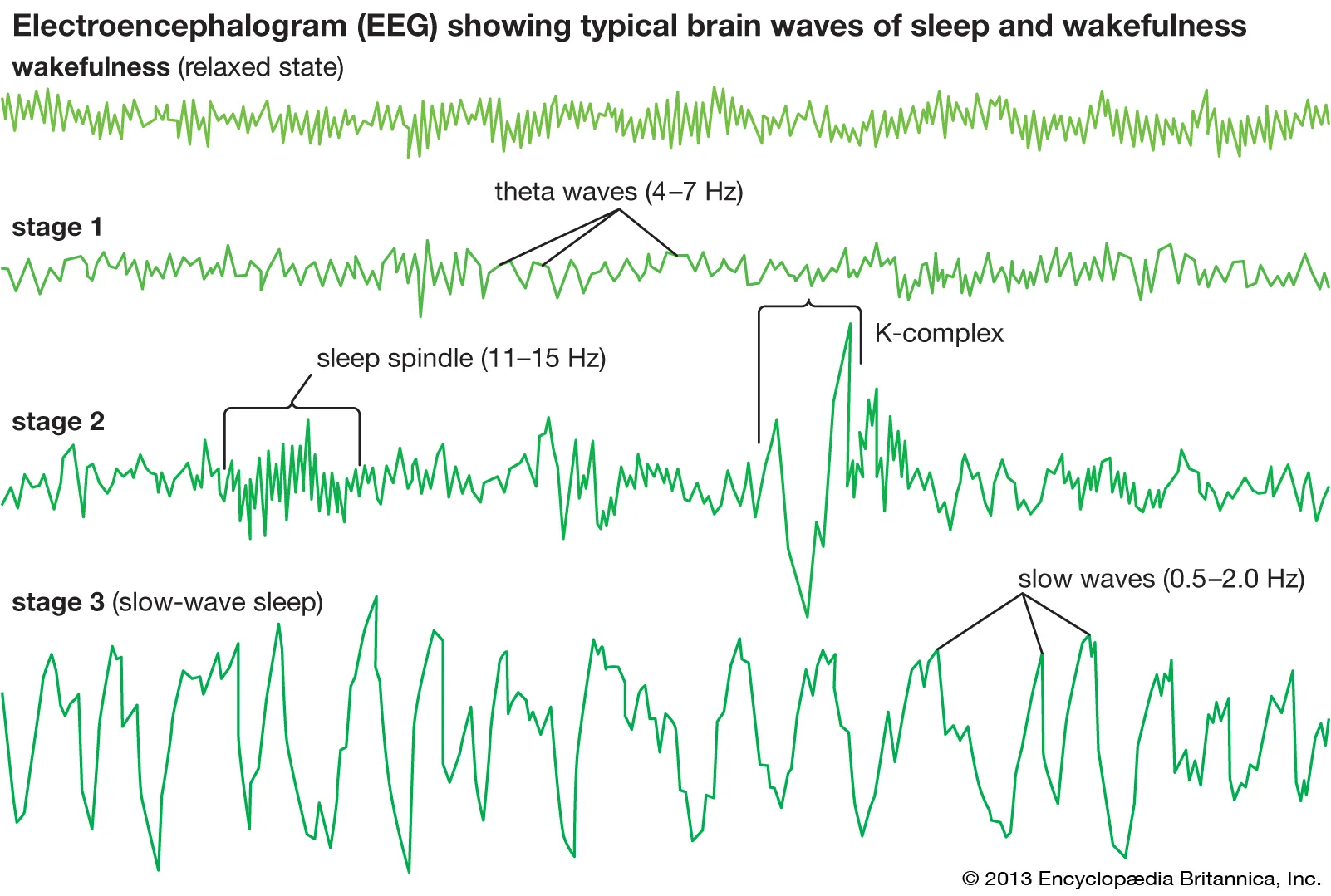 <p><strong>recording of the waves of electrical activity </strong>sweeping across brain’s surface.used to study brai during states of arousal such as sleeping dreaming—-DOES NOT PROVIDE STRUCTURE NOR FUNCTION</p>