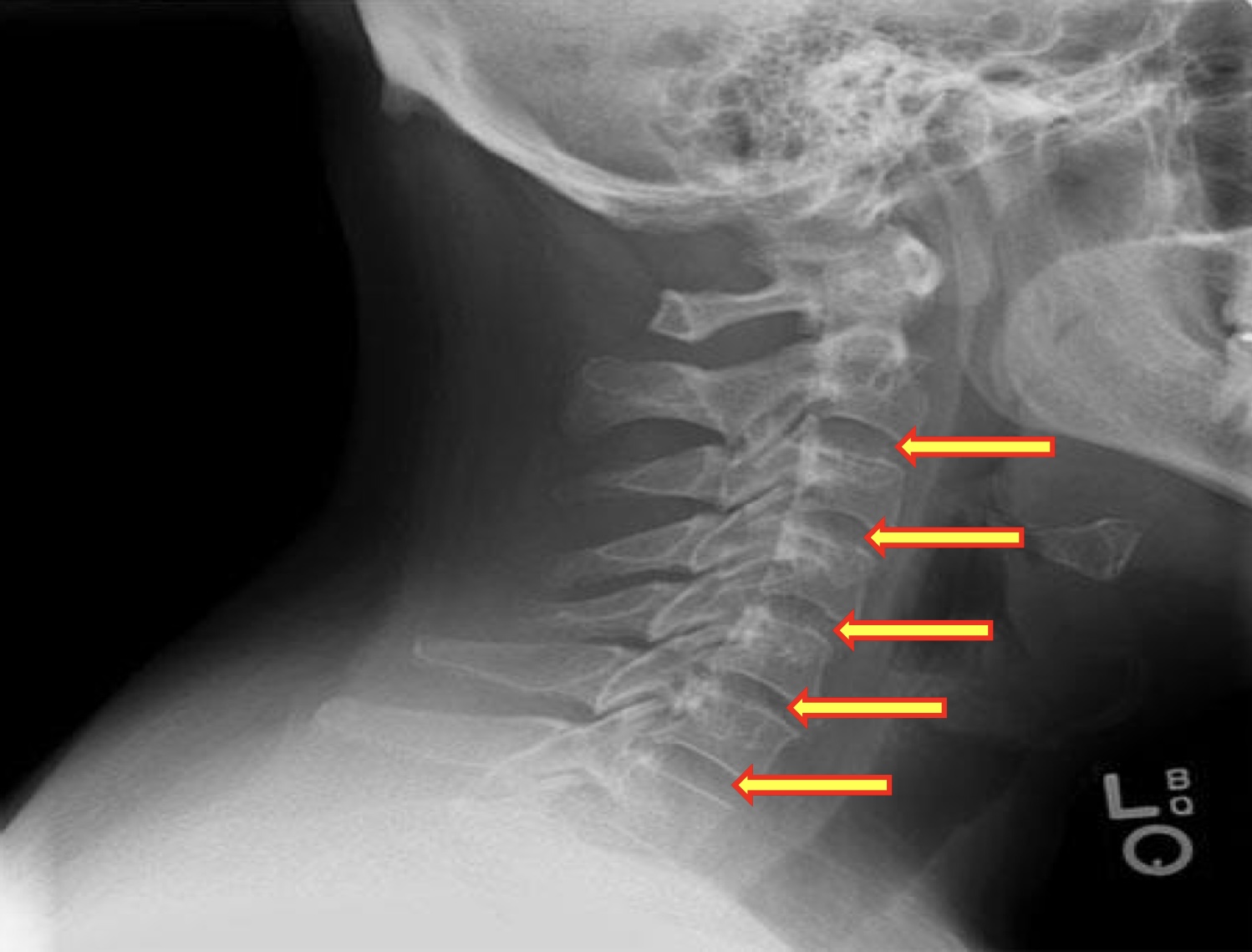 <p>Name the arrows</p>