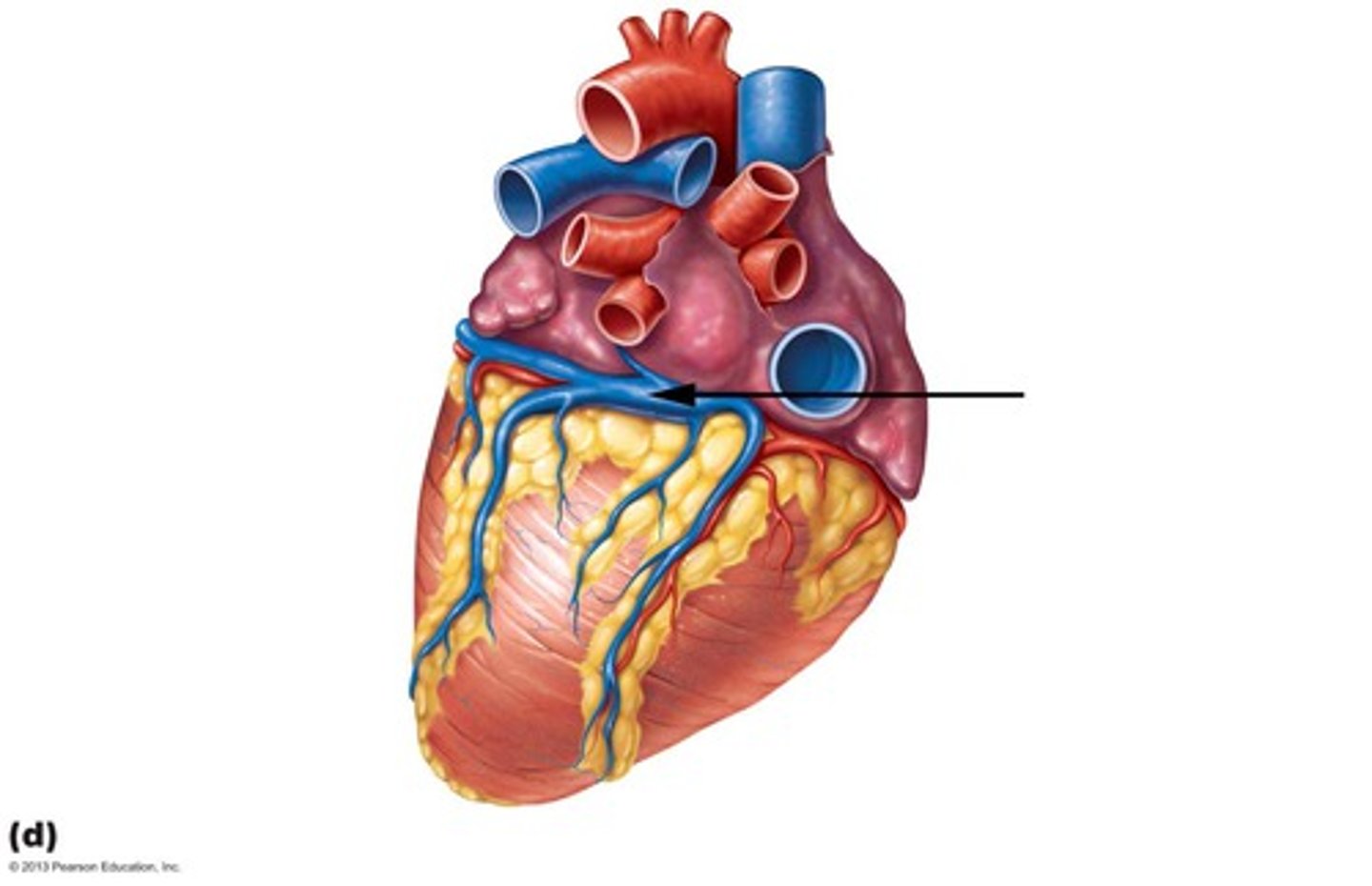 <p>enlarged vessel on the posterior aspect of the heart that empties blood into the right atrium</p>