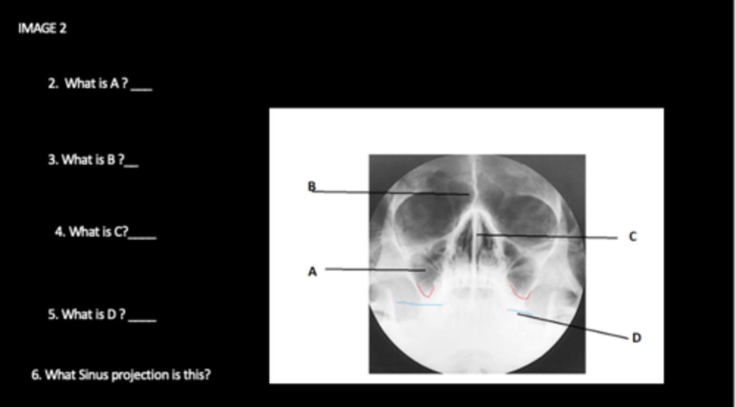 <p>What is B?</p>