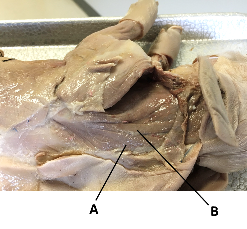 <p><span><span>Identify the muscle labeled with the letter A.</span></span></p>