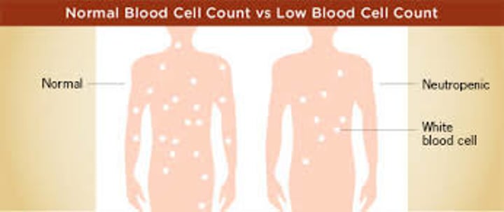 <p>abnormally low leukocyte count; commonly caused by certain drugs (corticosteroids and anticancer agents)</p>