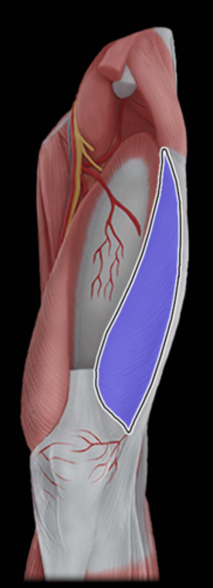<p>What Muscle Is Highlighted?</p>