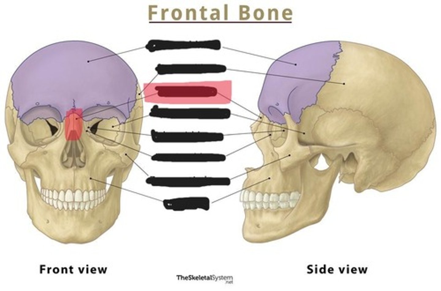 <p>Nasal bone</p>