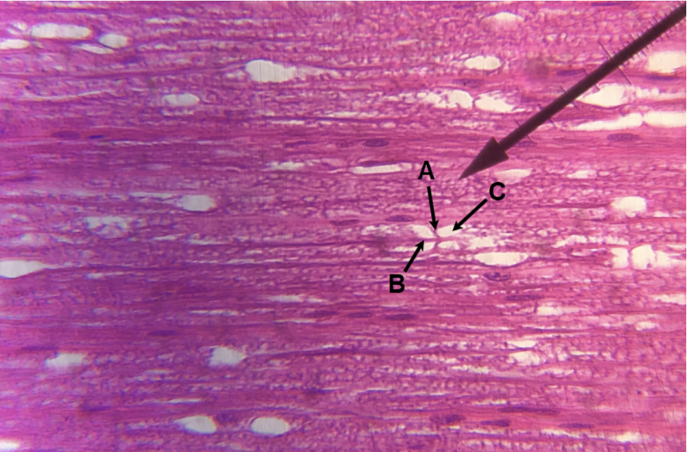 <p><span><span>In the image above, identify structures A-C. (Hint: B is purple, C is white.)</span></span></p>