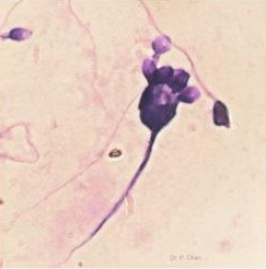 <p>Identify the sperm morphology.</p>