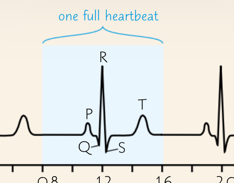 <p>What is a P Wave?</p>
