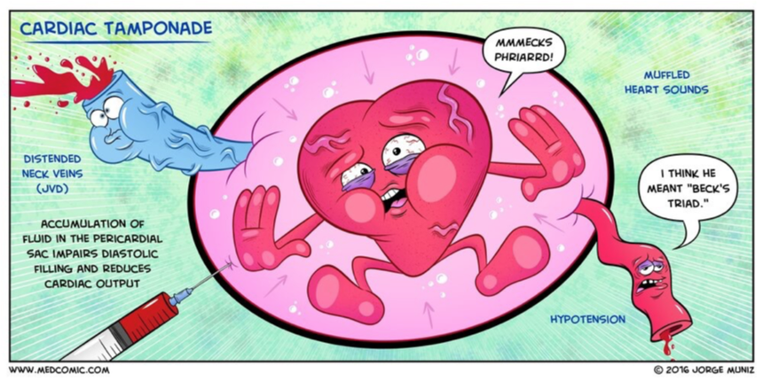 <p>Cardiac tamponade</p>