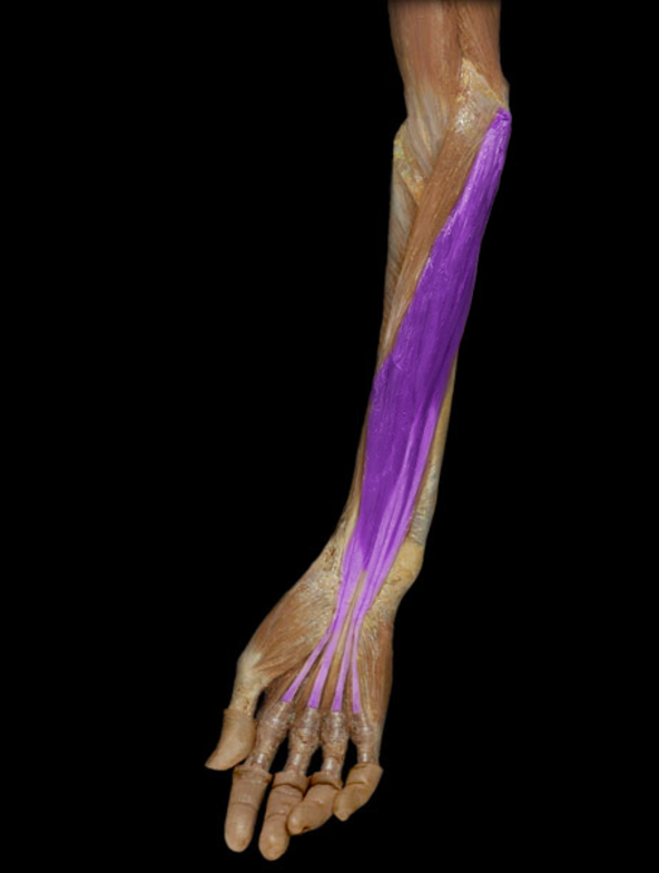 <p>Flexor digitorum superficialis</p>