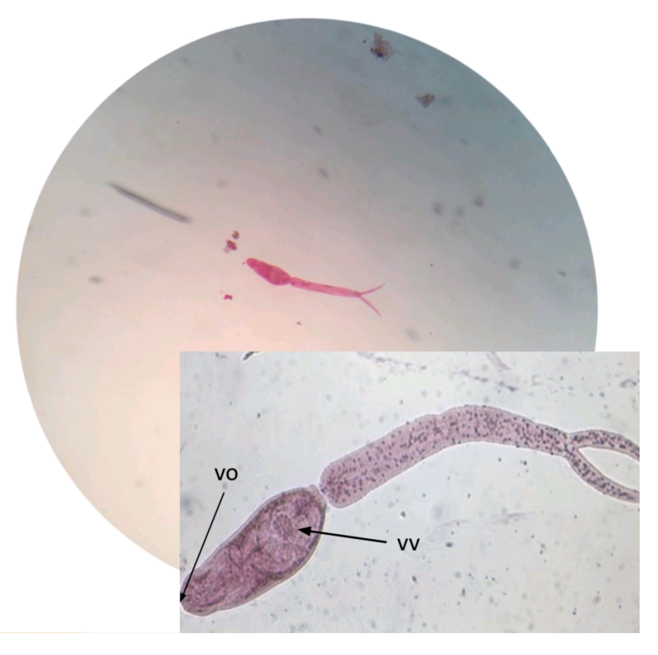 <p>Sobre o(s) parasito(s) na foto, escreva:</p><ul><li><p><strong>NOME CIENTÍFICO</strong></p></li><li><p><strong>FORMA EVOLUTIVA</strong> (+ <strong>SEXO</strong> - <u>se houver</u>)</p></li></ul>