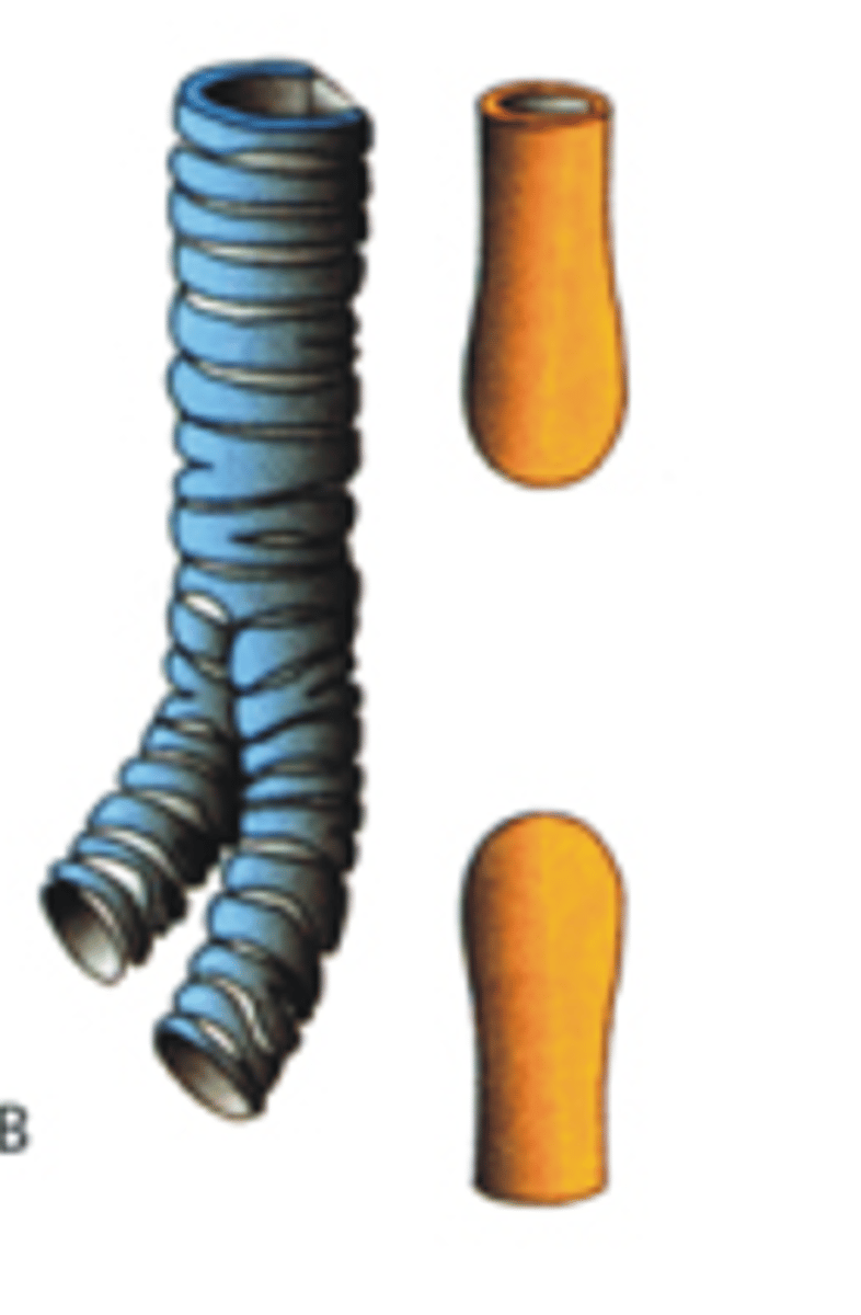 <p>Hoe heet dit type anomalie aanwezig thv de oesophagus?</p>