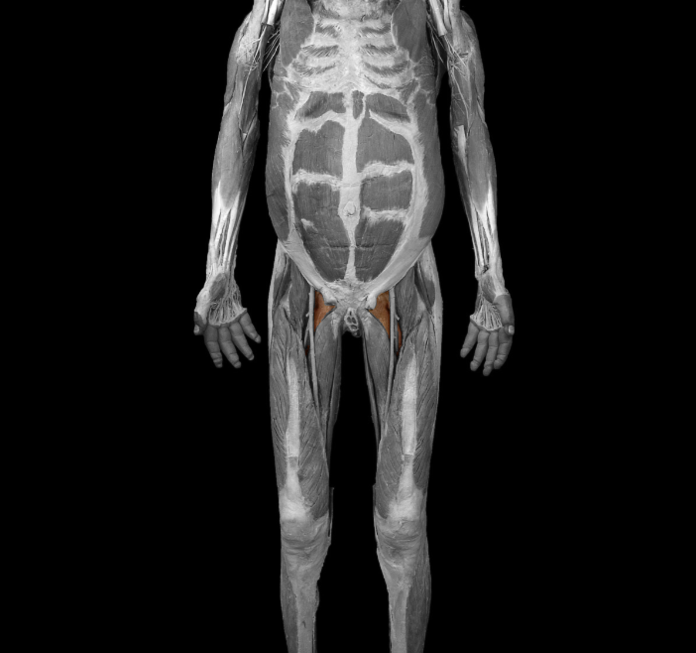 <p>origin: superior ramus of pubic </p><p></p><p>insertion: pectineal line of femur</p><p></p><p>action: flex + adduct thigh </p><p></p><p>innervation: femoral nerve </p>