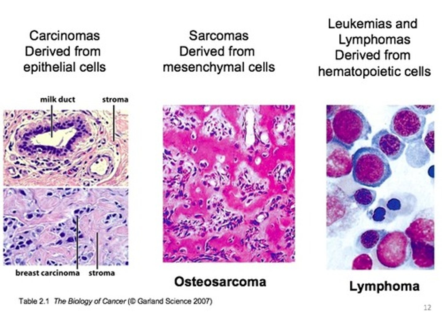 <p>a) mesenchymal connective tissue</p>