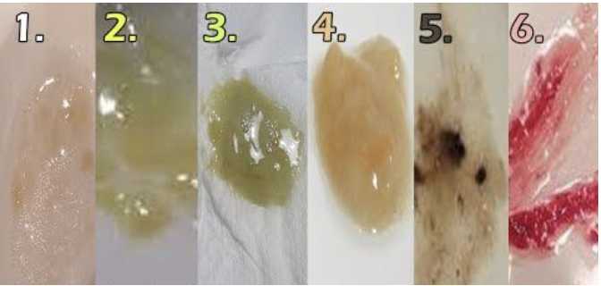 <p><span>How would you document each type of sputum?</span></p><p></p>