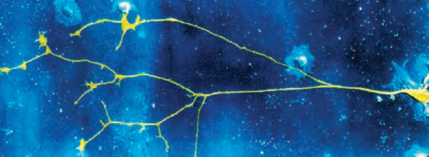 <p>A cell body linked to a nerve fibre</p>