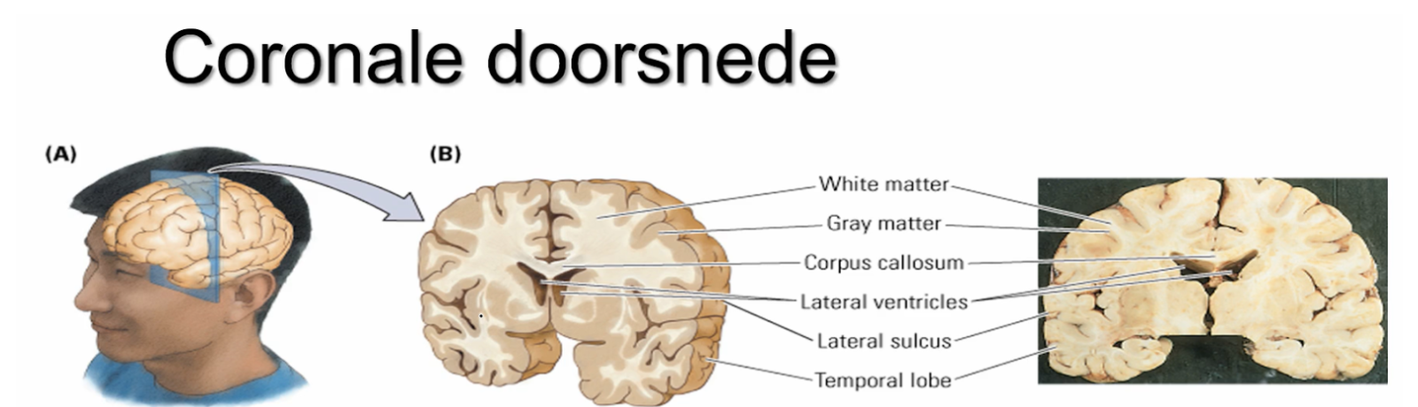 <p>Corpus callosum </p>
