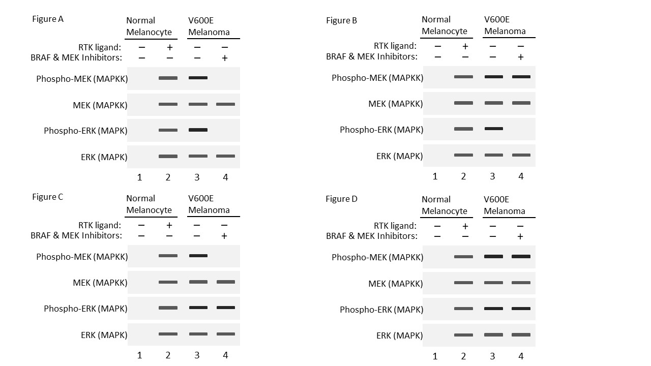 <p>Approximately half of all melanoma cancers contain a mutation in the MAPKKK protein BRAF. Substitution of glutamic acid for valine at amino acid 600 (V600E) is the most common mutation and constitutively activates the BRAF MAPKKK protein. Tumors with this mutation are often more difficult to treat and more deadly making this the target of several new chemotherapy treatments. The following western blot (Figure 1) shows the total levels of MEK (MAPKK) and ERK (MAPK) and the levels of phosphorylated MEK and ERK in normal melanocytes (not cancerous) in the absence of signaling RTK ligand (−) and presence of signaling RTK ligand (+) and in V600E melanoma cells in the absence of signaling RTK ligand (−) (RTK is a receptor tyrosine kinase). Note the levels of phospho-MEK and phospho-ERK are increased in melanoma cancer cell lines with the BRAF V600E mutation even in the absence of signaling ligand.</p><p>Targeted chemotherapy drugs have been developed that, when used in combination, inhibit both BRAF V600E and MEK kinase domains. In other words, the drugs inhibit the ability of the V600E BRAF and MEK kinases to phosphorylate their target proteins (see Lane 4 of the following graphs). Which of the following western blots accurately shows the expected results of inhibiting BRAF V600E MAPKKK and MEK MAPKK in V600E melanoma cells?</p><p></p><p>Choose one:</p><p>A. Figure A</p><p>B. Figure B</p><p>C. Figure C</p><p>D. Figure D</p>