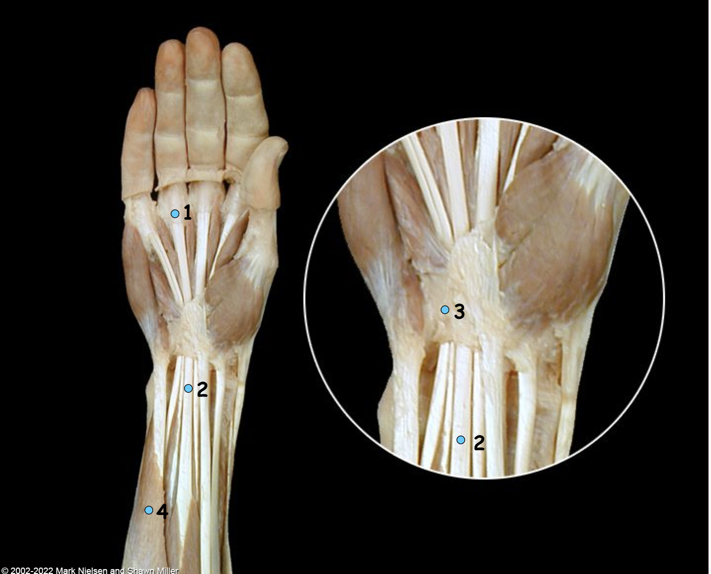 <p>What is number 4?</p>