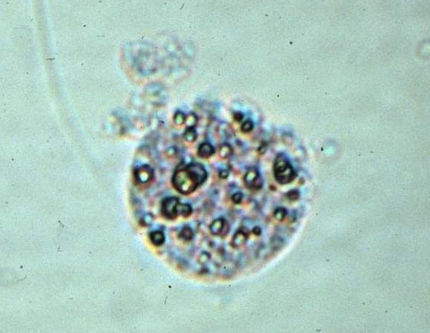 <p><span style="color: #000000">What is this?</span></p><p><span style="color: #000000">What is the correct name for cells with fat in them?</span></p><p><span style="color: #000000">What stain is used for these cells?</span></p>