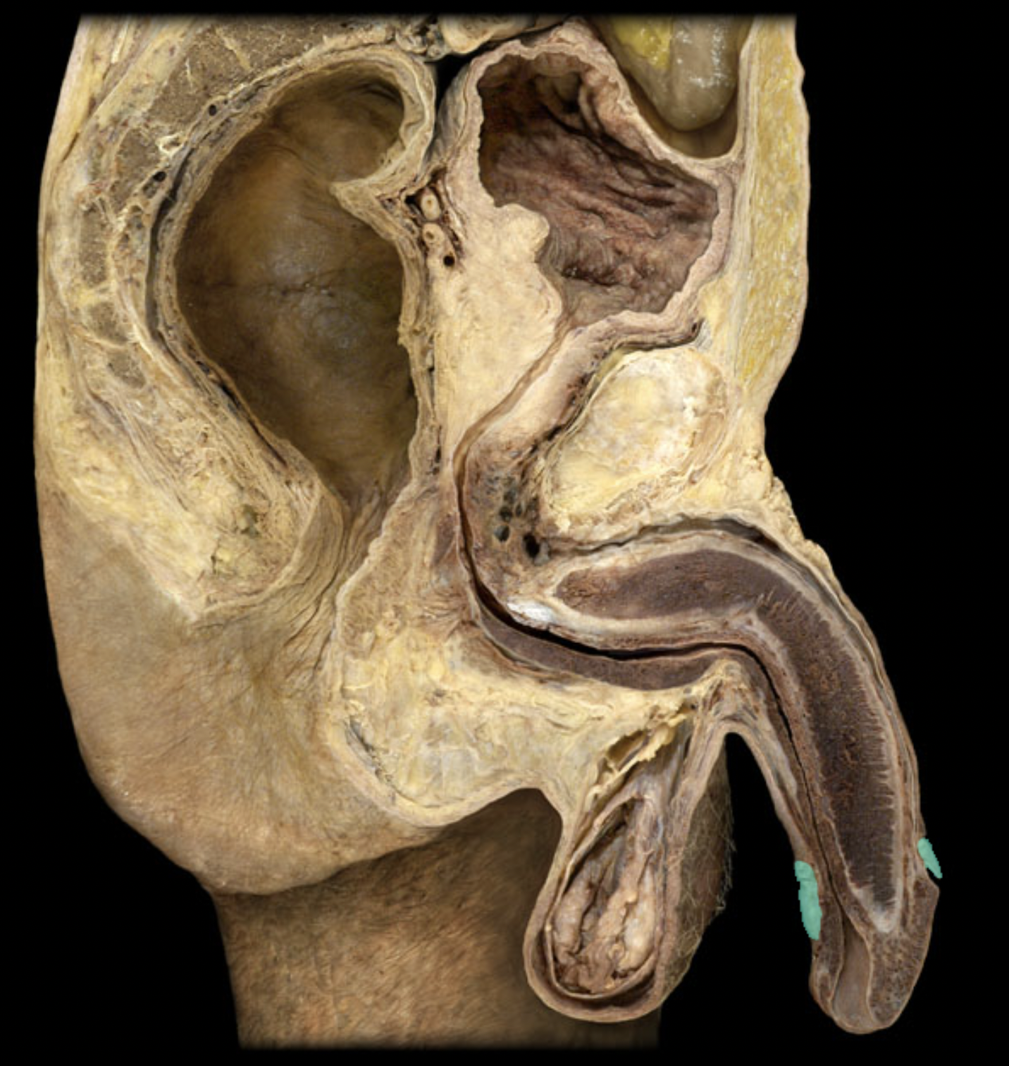 <p>What structure is shown?</p>