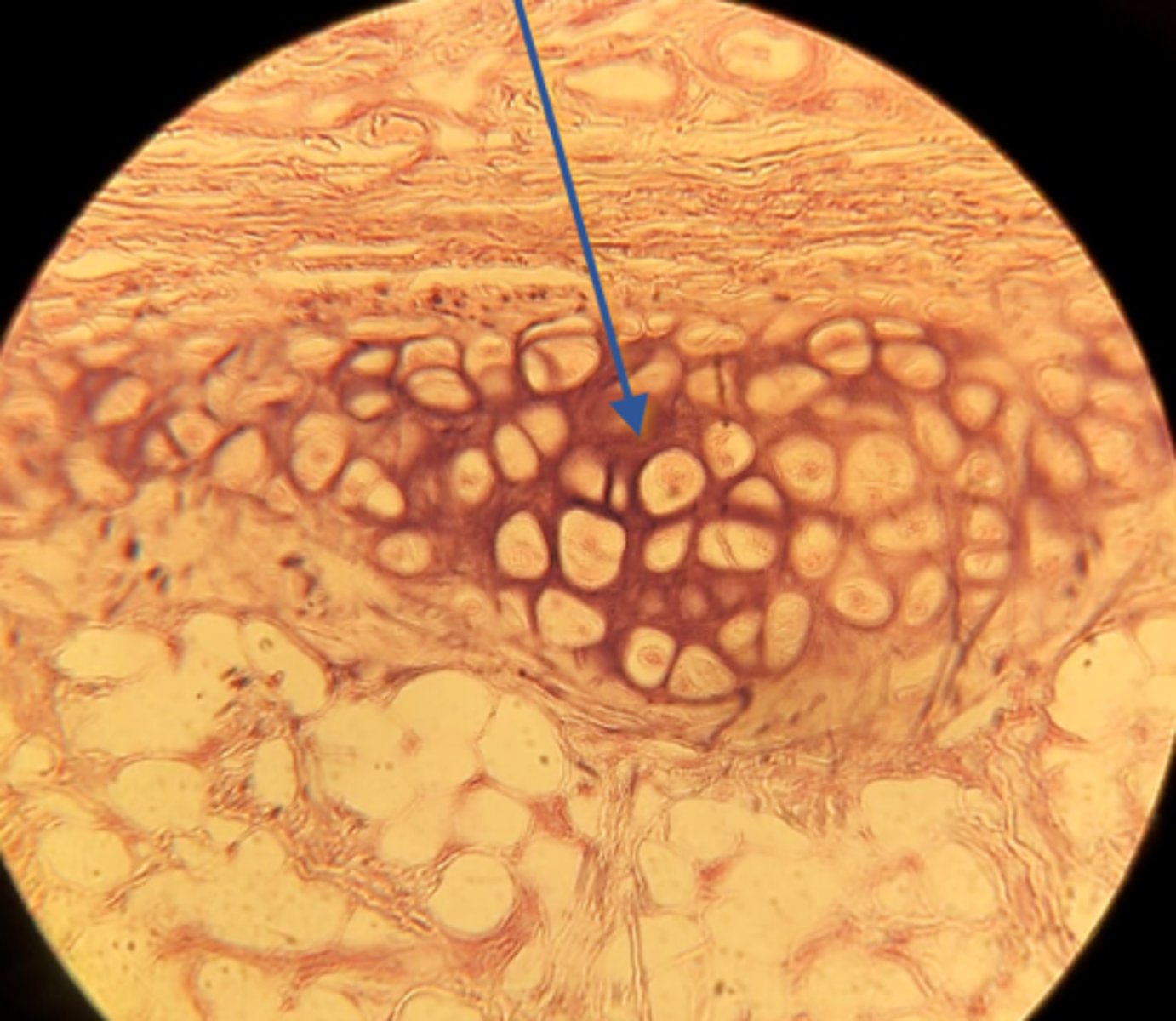 <p>Name the tissue at the pointer</p>