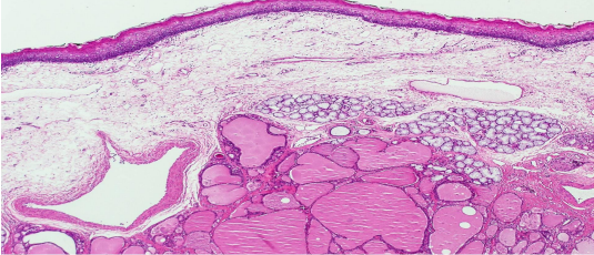 <p>identify ? </p><p>other types of developmental disordered growth </p>