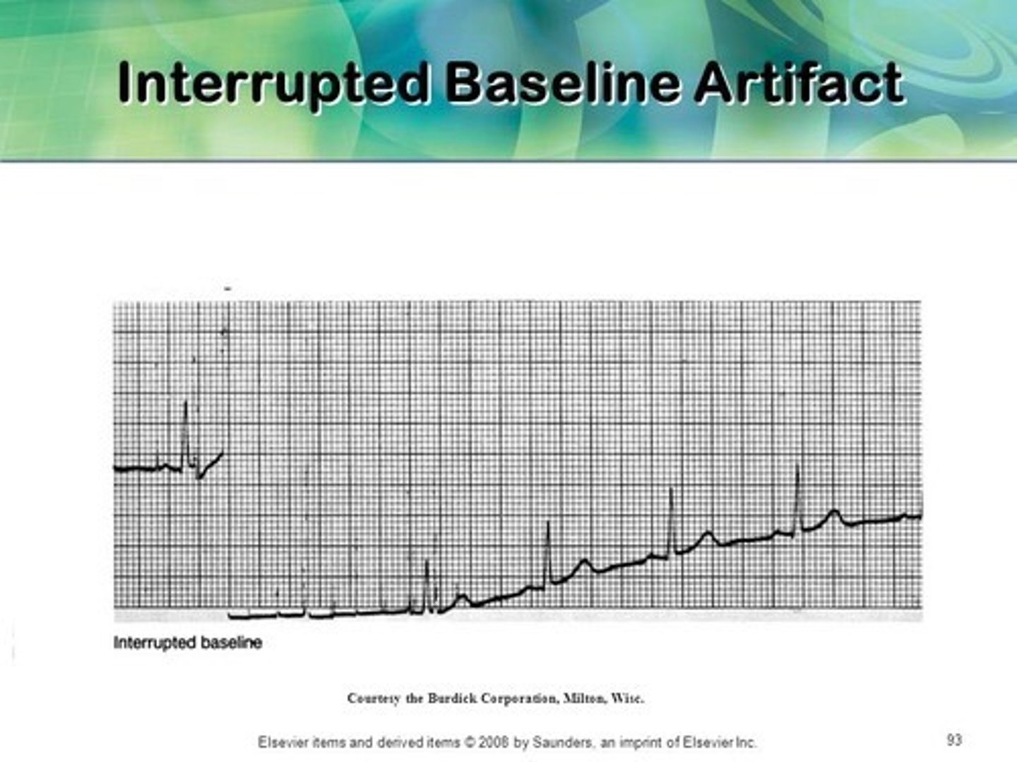 <p>Lead corrosion</p>