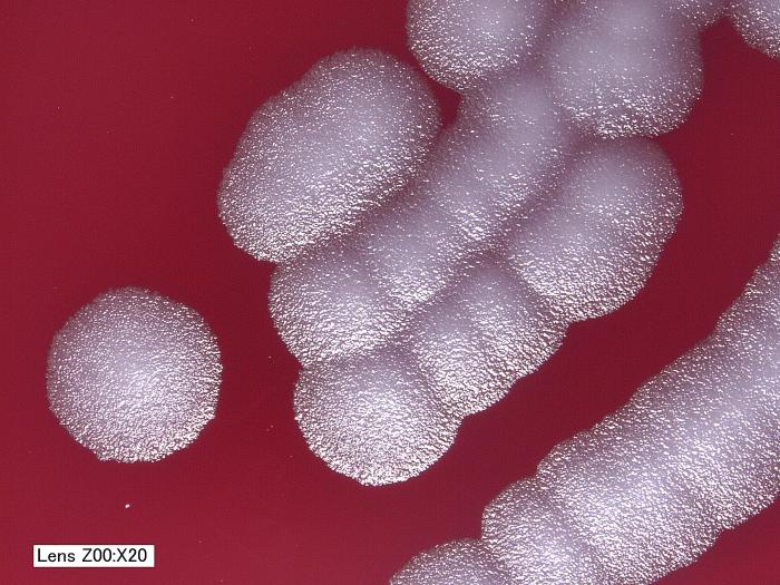 <p>They appear as “ground-glass” on the surface of the colony and have irregular edges, often described as “medusa’s head”</p>