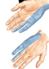 <p>majority of intrinsic muscles in hand (Think U)</p>