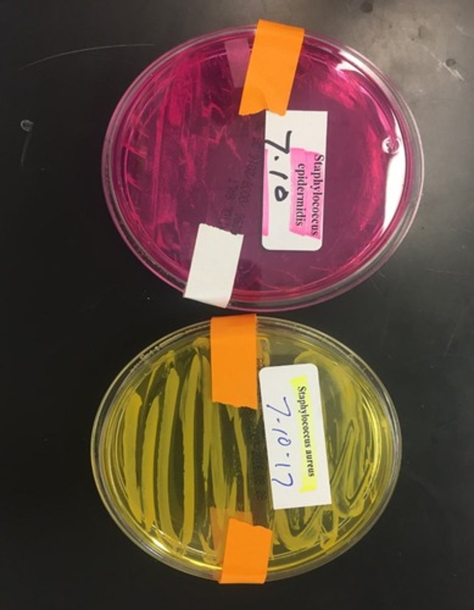 <p>Selective for Staphylococcus; differential for mannitol fermentation.</p>