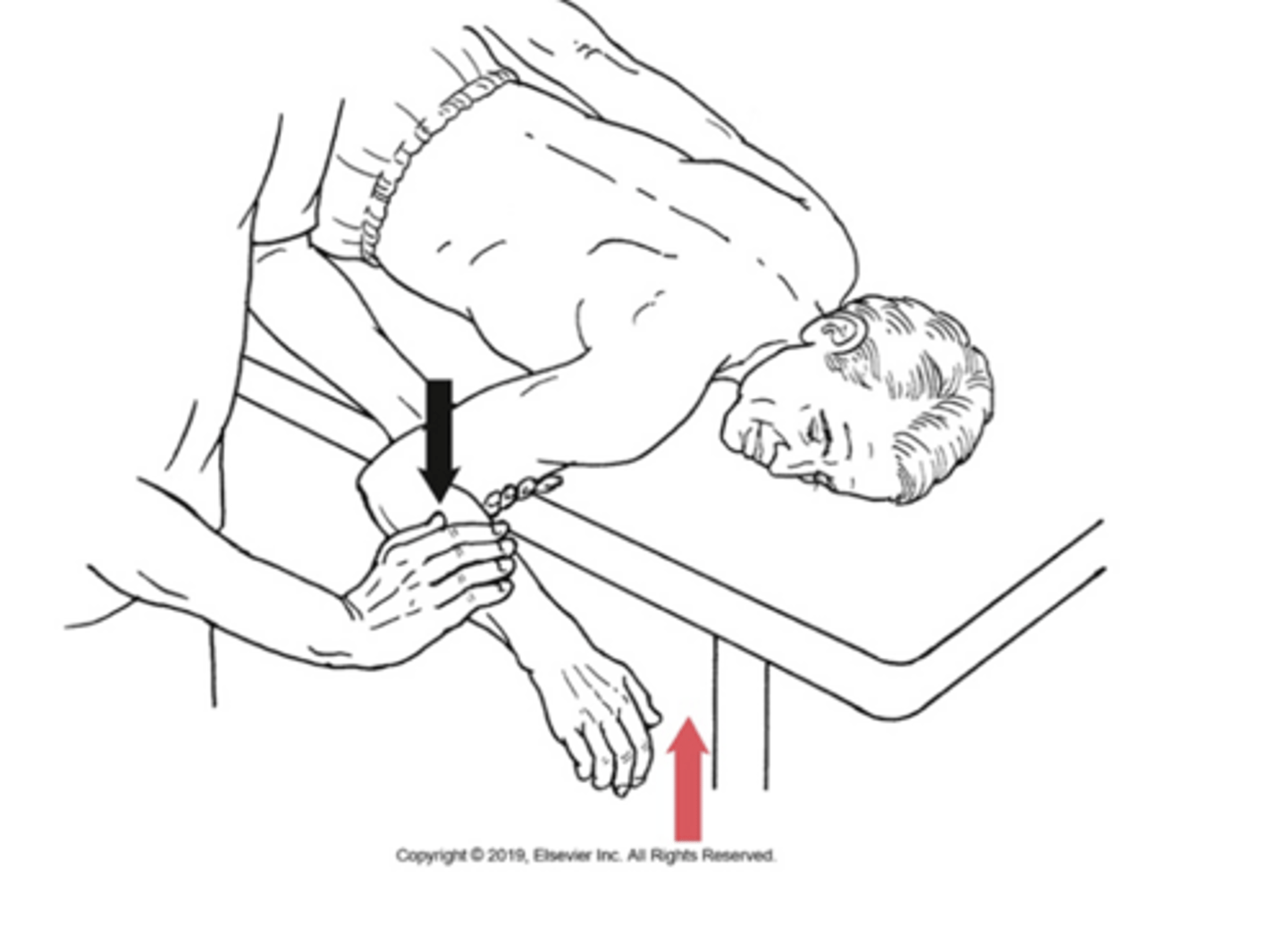 <p>infraspinatus ; teres minor</p>