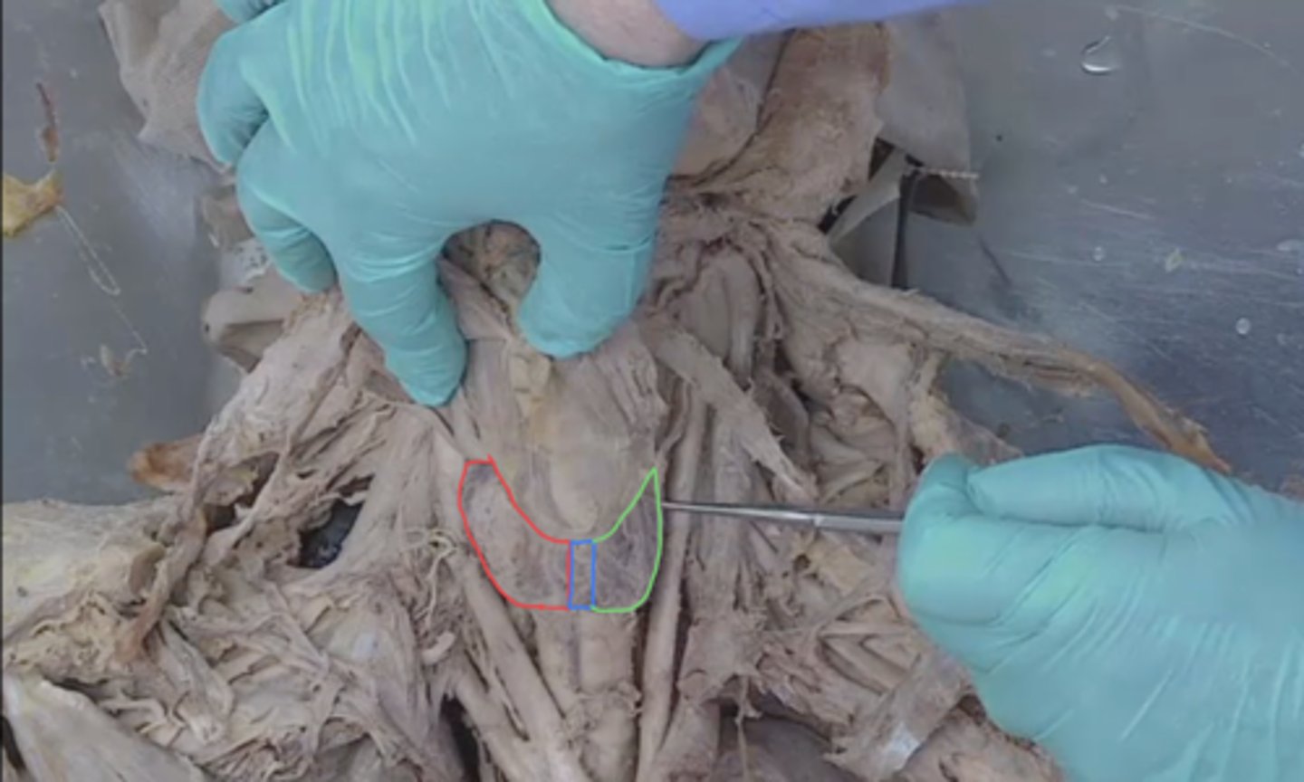 <p>identify this structure in blue</p>