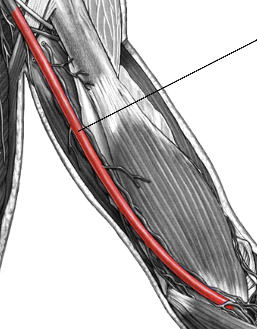 <p>Which arteries:</p><ul><li><p>Runs medially to biceps brachii</p></li><li><p>Extends from axillary artery</p></li></ul><p></p>