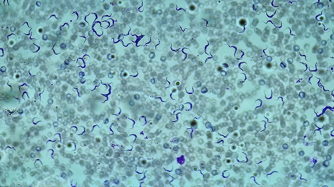 <p><span data-name="microscope" data-type="emoji">🔬</span><span data-name="petri_dish" data-type="emoji">🧫</span><strong><span> </span>Na podstawie zdjęcia preparatu:</strong></p><p></p><ul><li><p><span data-name="book" data-type="emoji">📖</span><span> </span>rozpoznaj gatunek pasożyta;</p></li></ul><p></p><ul><li><p><span data-name="recycle" data-type="emoji">♻</span><span> </span>rozpoznaj wszystkie formy rozwojowe;</p></li></ul><p></p><ul><li><p><span data-name="microbe" data-type="emoji">🦠</span><span> </span>wskaż organelle i cechy charakterystyczne dla danego gatunku;</p></li></ul><p></p><ul><li><p><span data-name="mask" data-type="emoji">😷</span><span> </span>nazwij chorobę, którą pasożyt wywołuje.</p></li></ul><p></p>