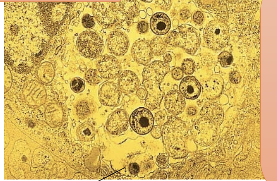 <p>Domain Bacteria : Chlamydias</p>