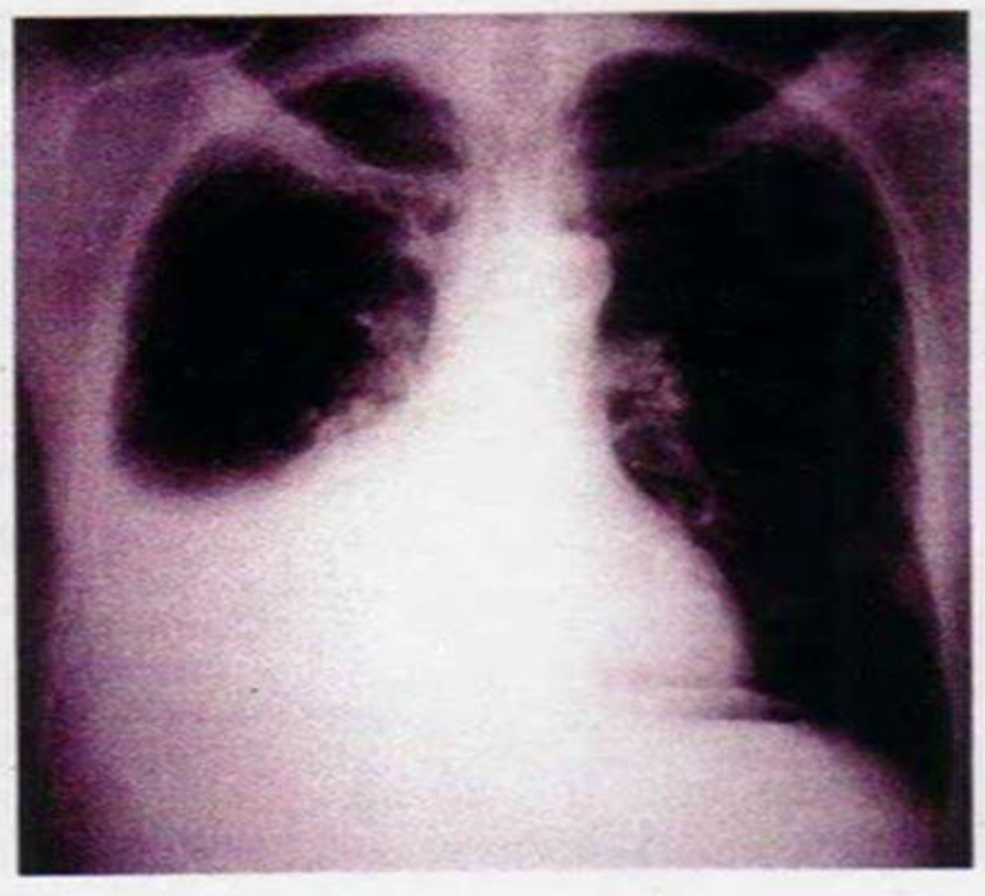<p>Disease; caused by?</p>