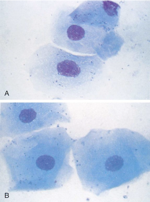 <p>Which epithelial cell type is characterized as larger than parabasal cells, less nucleus, more cytoplasm? </p>