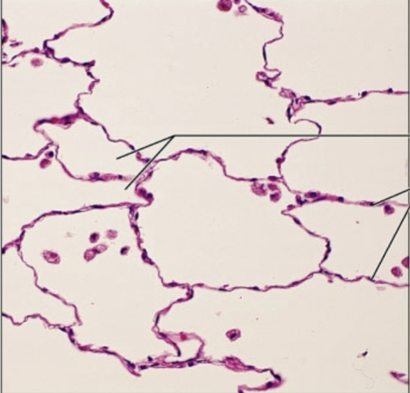 <p>what tissue is this</p>
