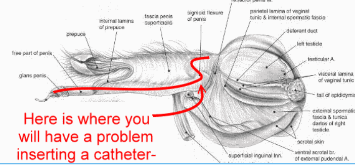 <p>urethral obstruction (partial/complete)</p><p>urethral rupture</p><p>bladder rupture</p>
