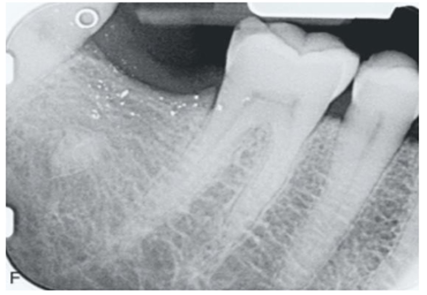 <p>What are these metallic specs?</p>