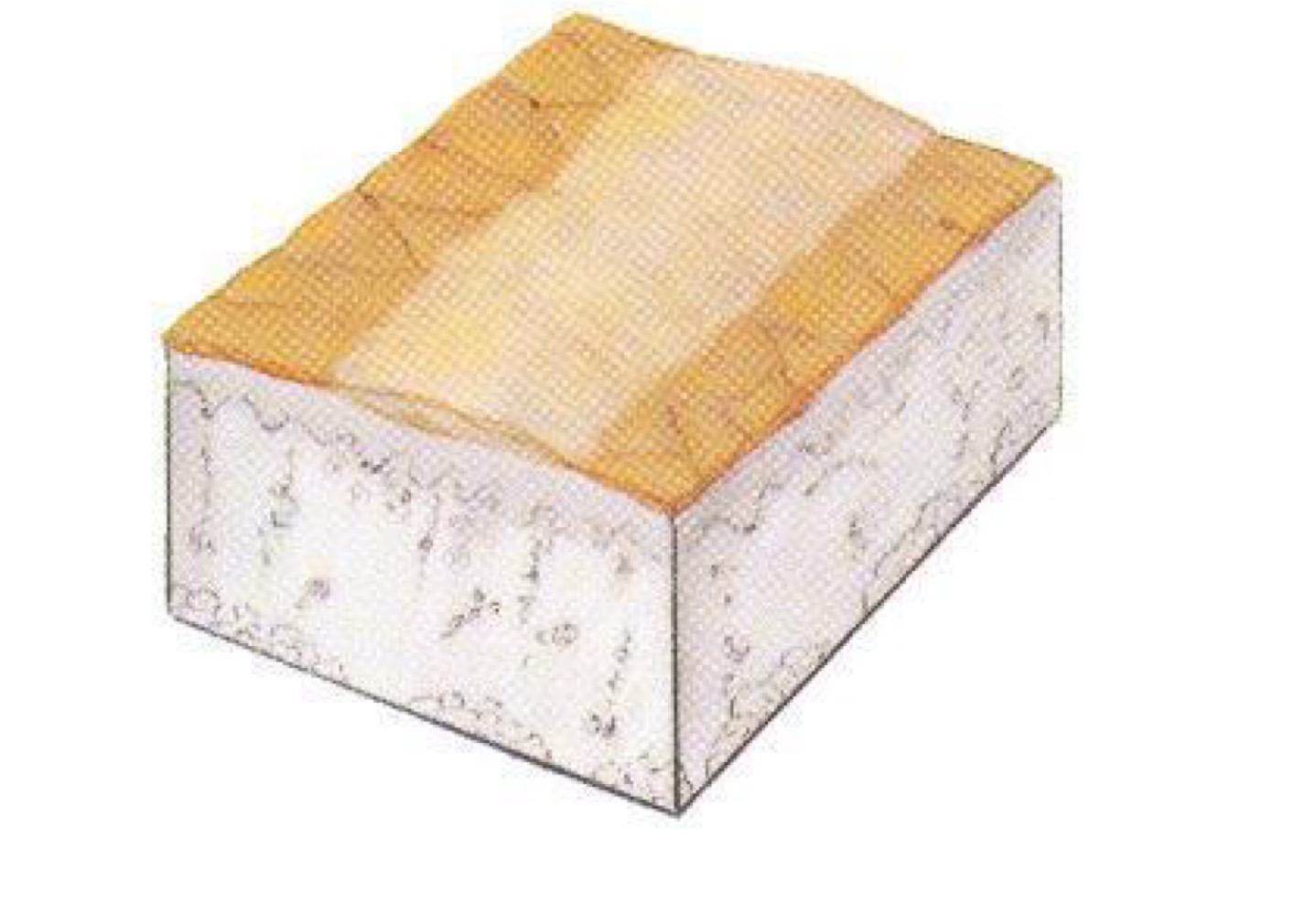 <p>what type of skin lesion is this? </p>