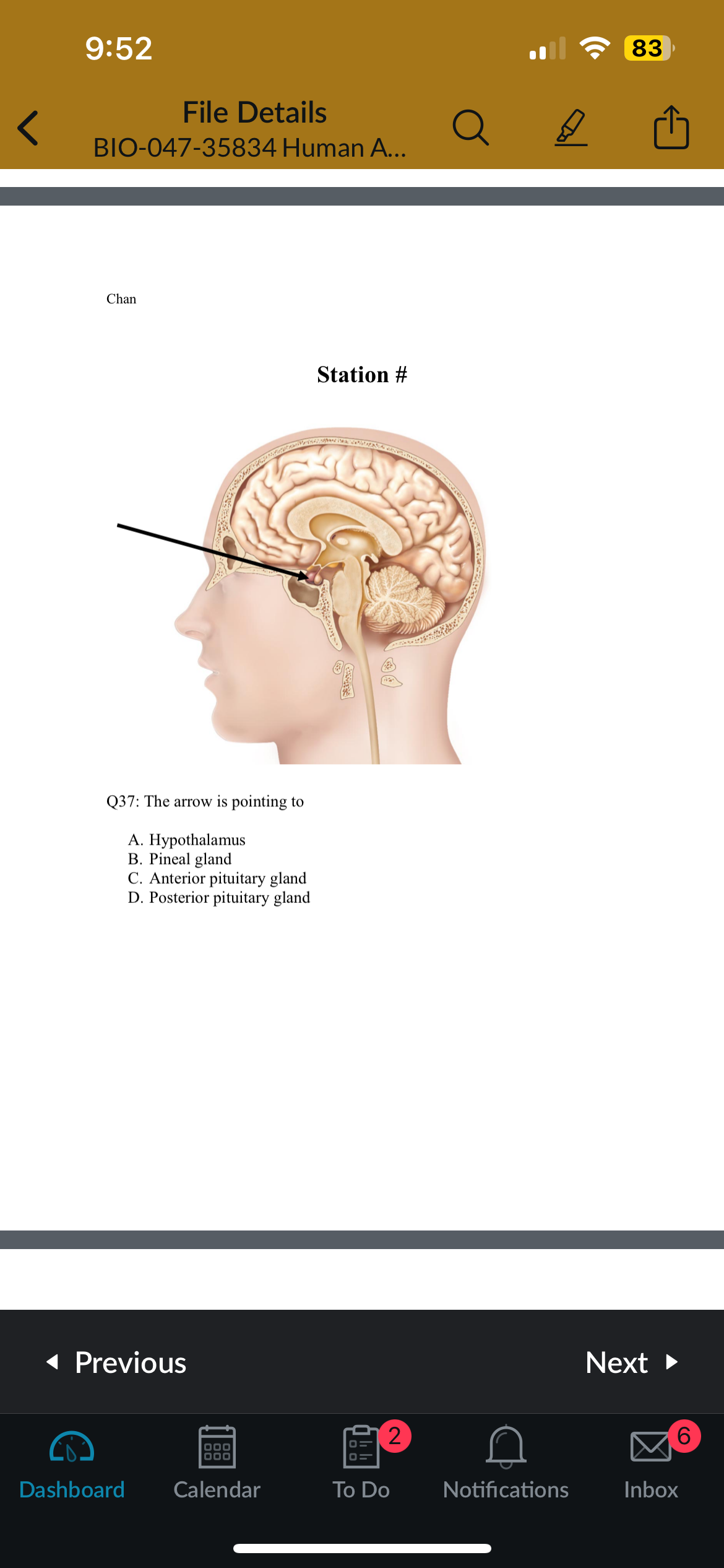 <p>Q37: The arrow is pointing to</p>