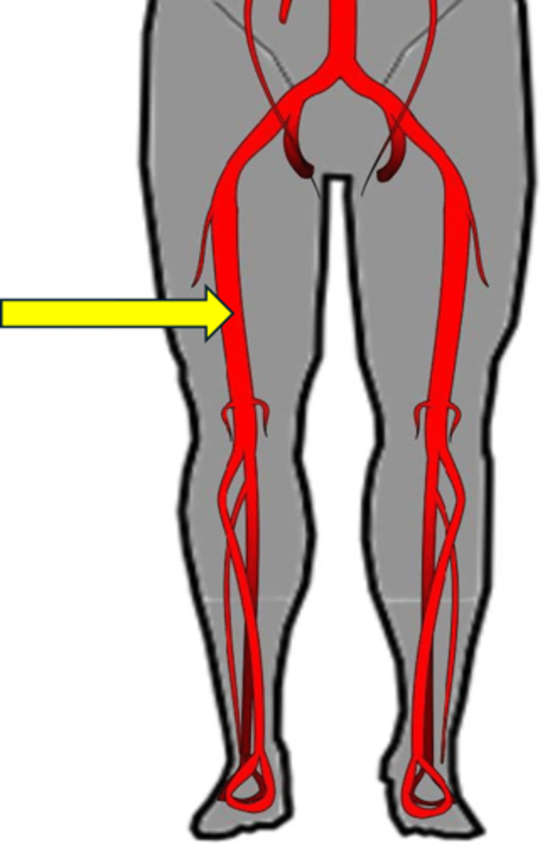 <p>Name the red vessel.</p>
