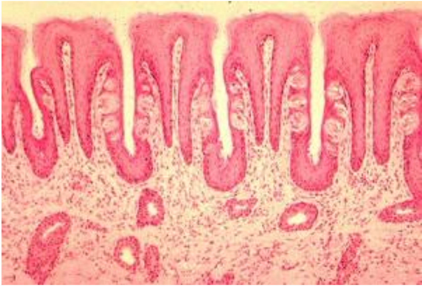 <p>ID the image. BE SPECIFIC</p>
