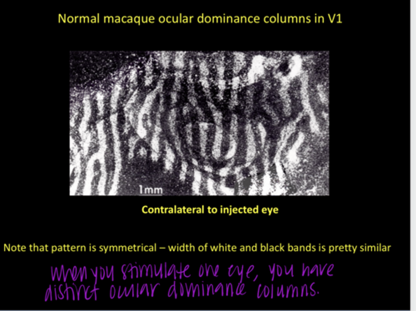 <p>Normal Ocular Dominance Columns in V1 (Pic)</p><p>**Width of black and white is symmetrical and similar</p>